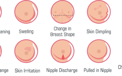 ATYPICAL SYMPTOMS OF BREAST CANCER