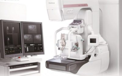 WHAT IS A MAMMOGRAM?