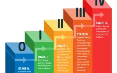 Breast Cancer Stages: Understanding the Journey