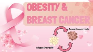 The Link Between Obesity and Breast Cancer