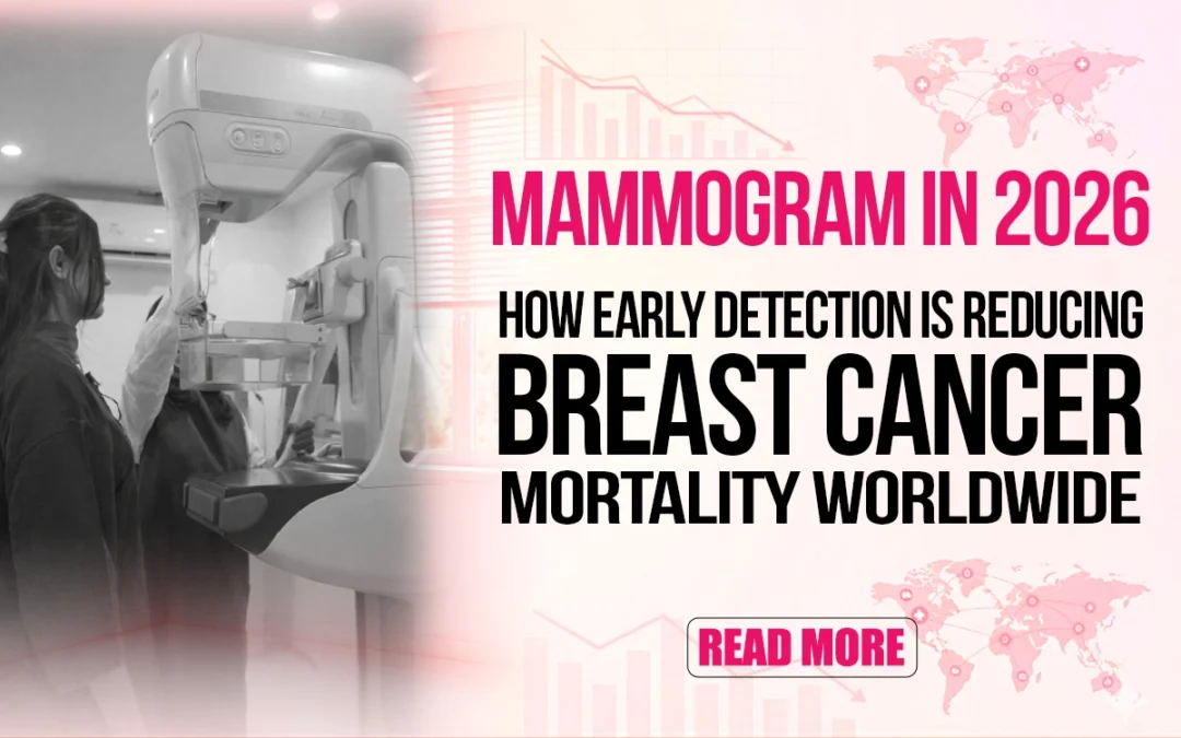 Mammogram in 2026: How Early Detection is Reducing Breast Cancer Mortality Worldwide