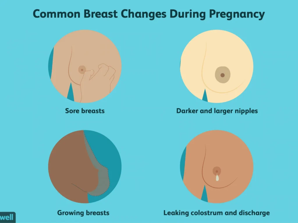 Breast Changes During Pregnancy vs Breast Cancer