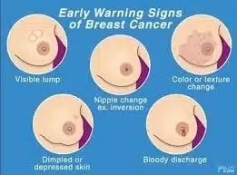 early warning signs of breast cancer