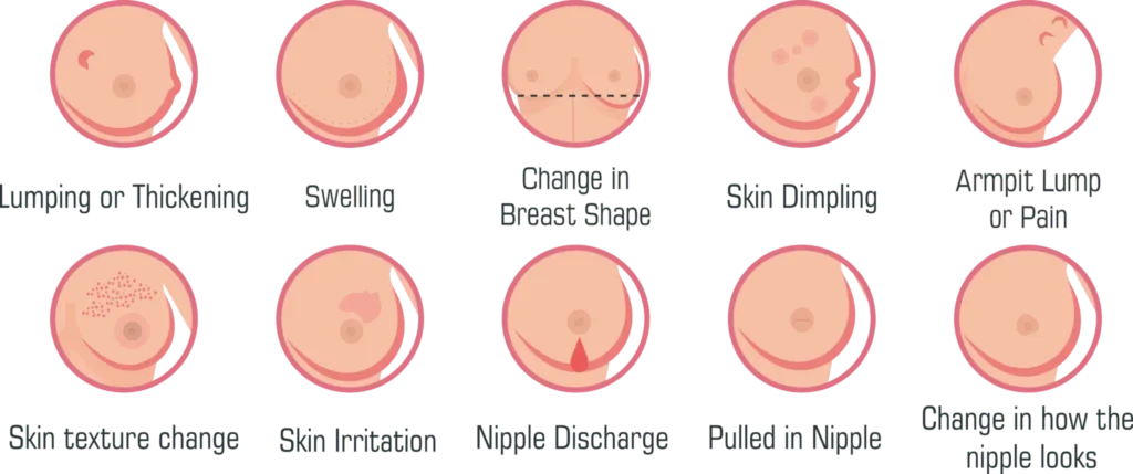 Atypical Symptoms of Breast Cancer