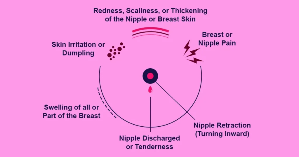 Atypical Symptoms of Breast Cancer