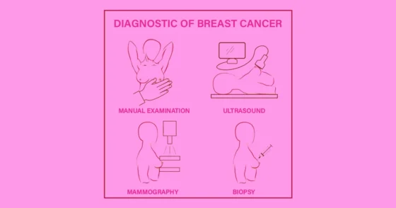 Breast Cancer Diagnosis